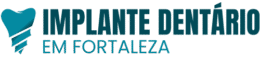 Implante Dentário Fortaleza